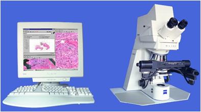 BLISS (Bacus Laboratories, Inc. Slide Scanner) System - (~1994)