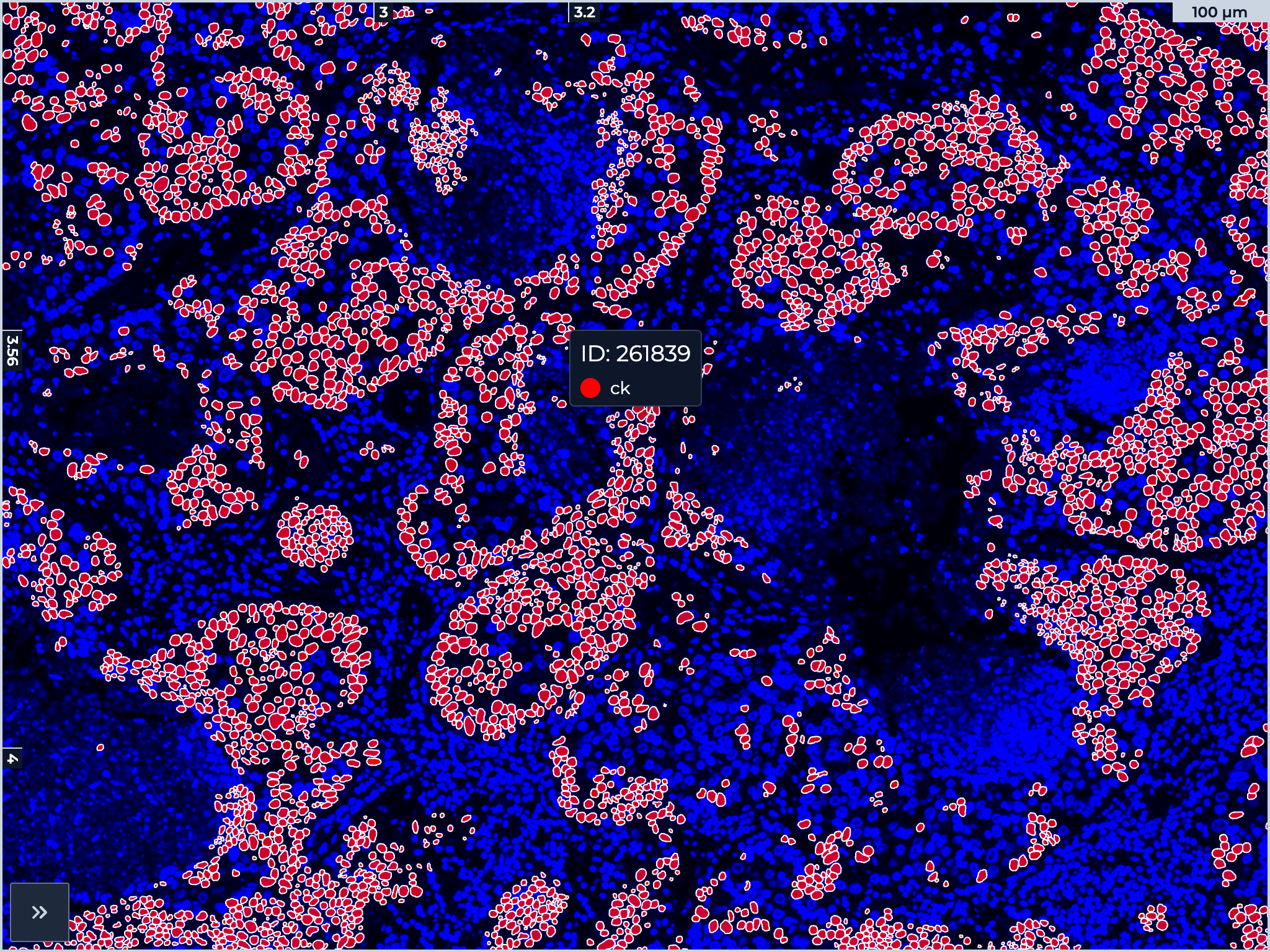 Client-Side Overlays for Digital Pathology